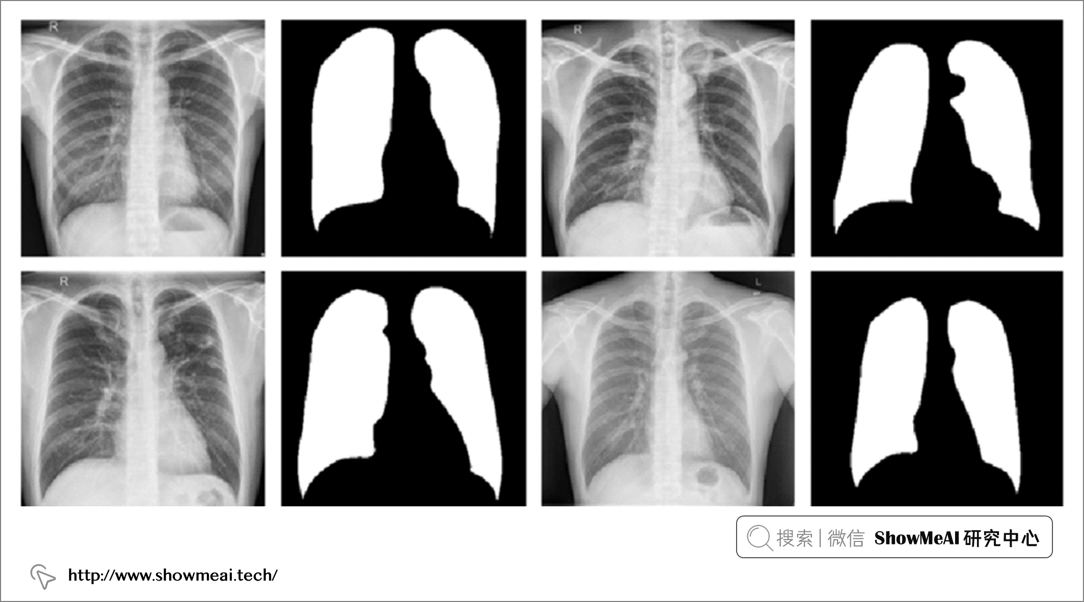 AI+Medical: Using Neural Networks for Medical Image Recognition and Analysis